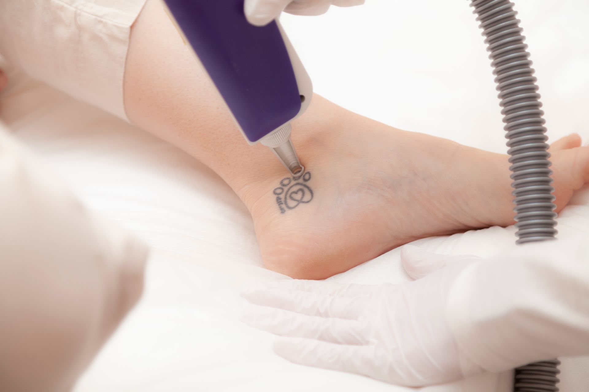 Woman Receiving Microneedling Treatment on Her Face by a Technician in a Salon — Eternal Radiance in Strathmore, VIC