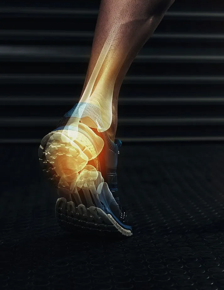 Anatomical illustration of a foot and ankle with highlighted bone structure, indicating pain.