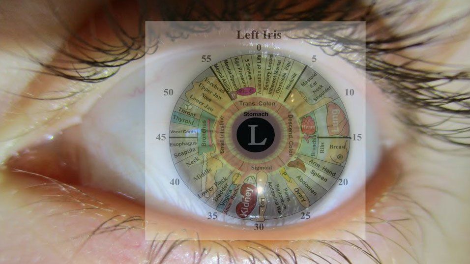 Iridology services Dr. Jan