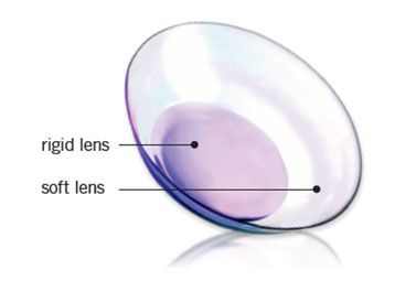 – Gas Permeable contact lenses