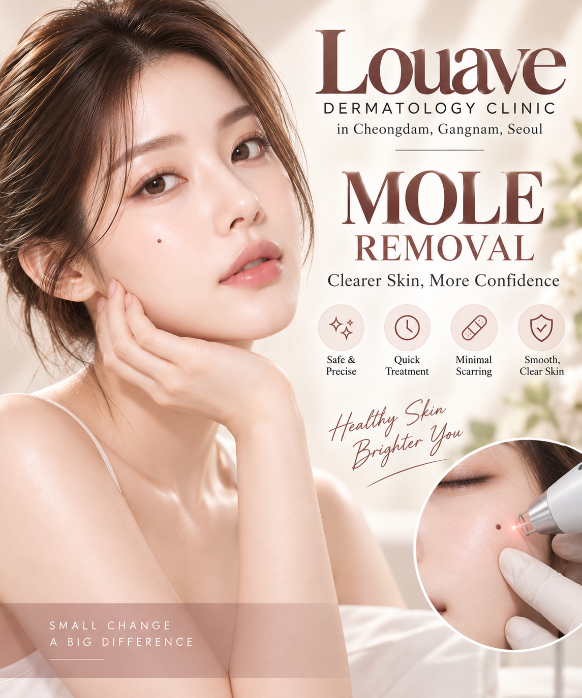 Laser mole removal at Louave Dermatology Clinic, Cheongdam, Seoul