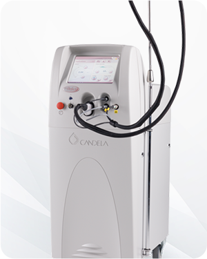 V-Beam Perfecta vascular laser