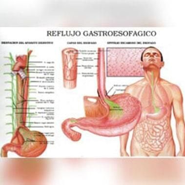 DR. FERNANDO SAMANIEGO VERDUZCO- laringe DR. FERNANDO SAMANIEGO VERDUZCO- laringe