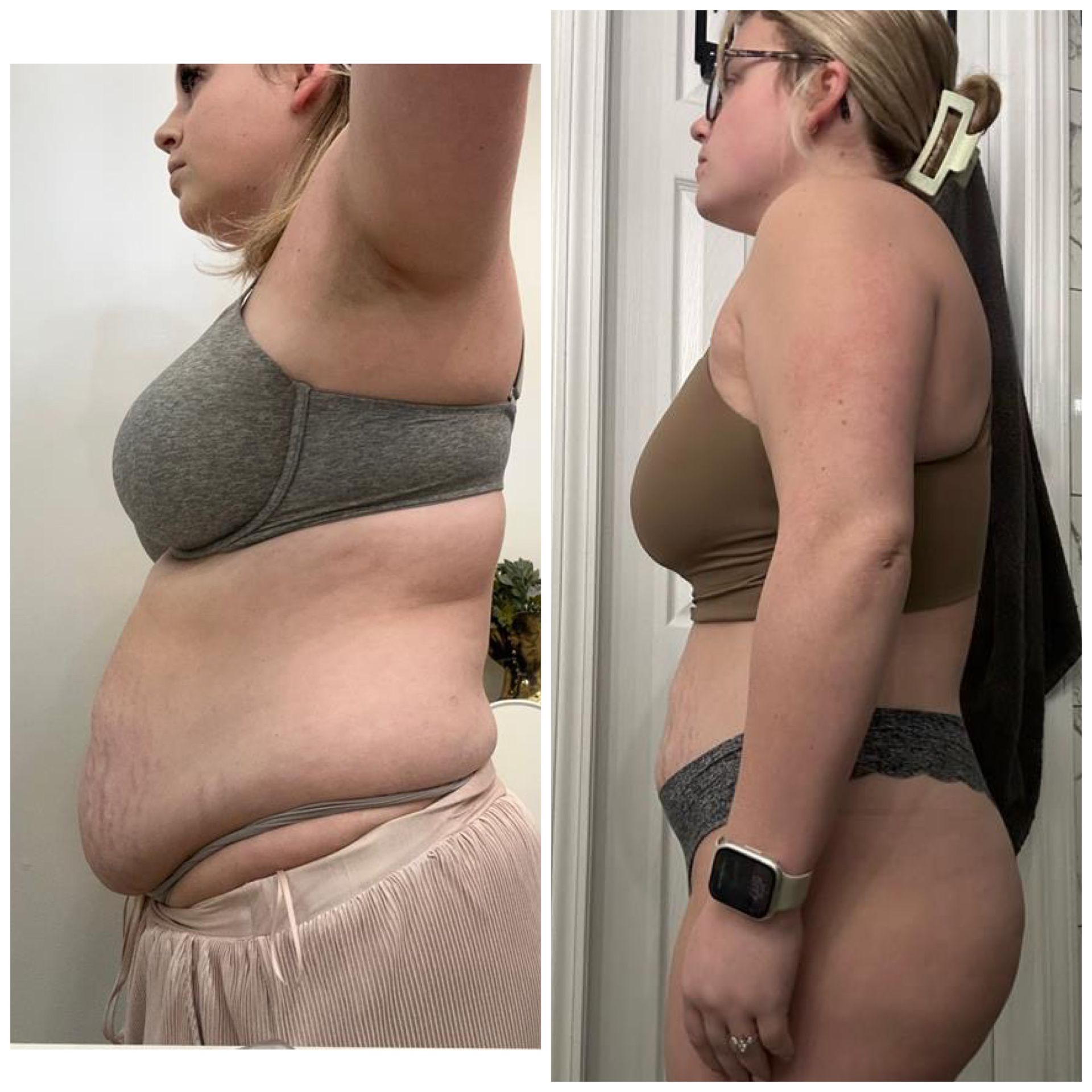 Side-by-side profile photos of a female showing a before and after transformation at 360 Image Fitness in Watkinsville, GA