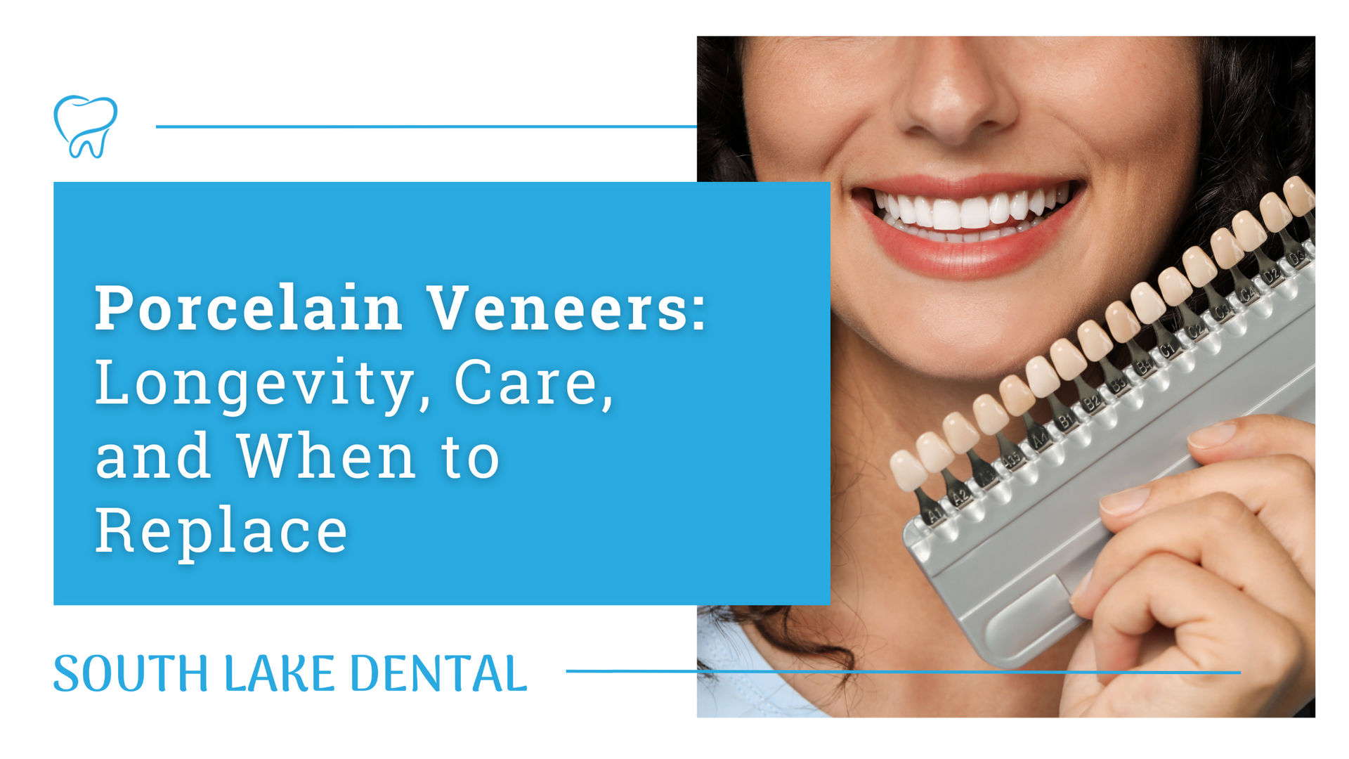 Dental ad for porcelain veneers with smiling mouth and veneer shade guide; South Lake Dental.
