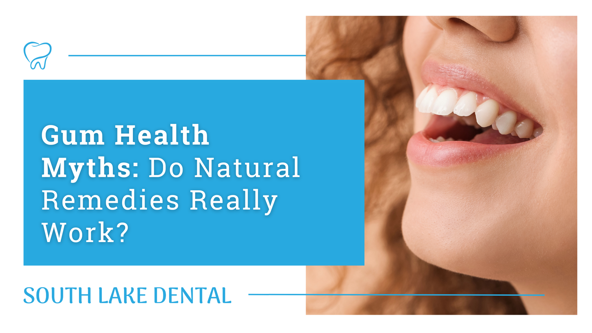 Blue dental promo with smiling mouth and text: “Gum Health Myths: Do Natural Remedies Really Work?”