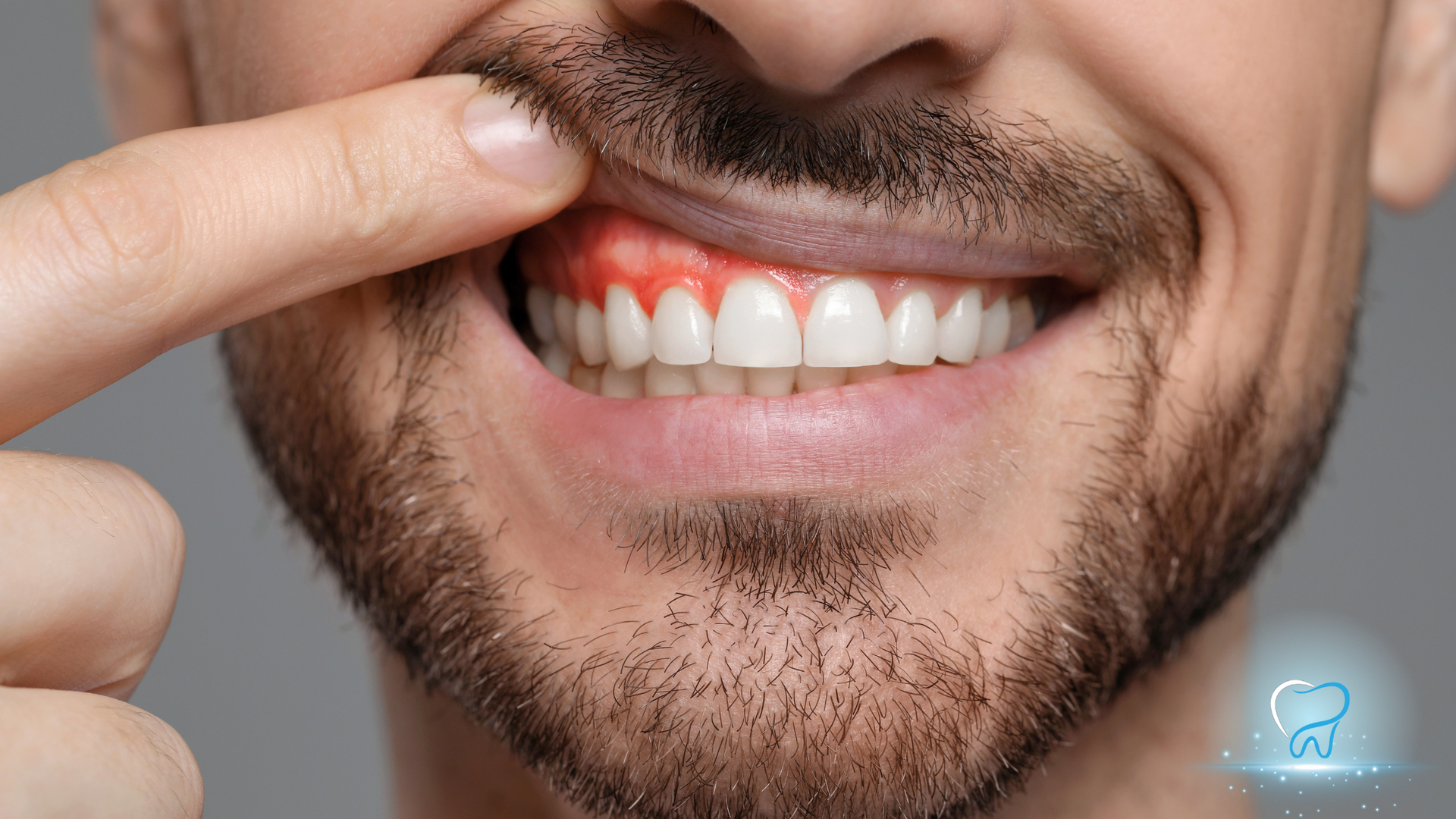 Finger pulling lip to show teeth and gums during a dental check.