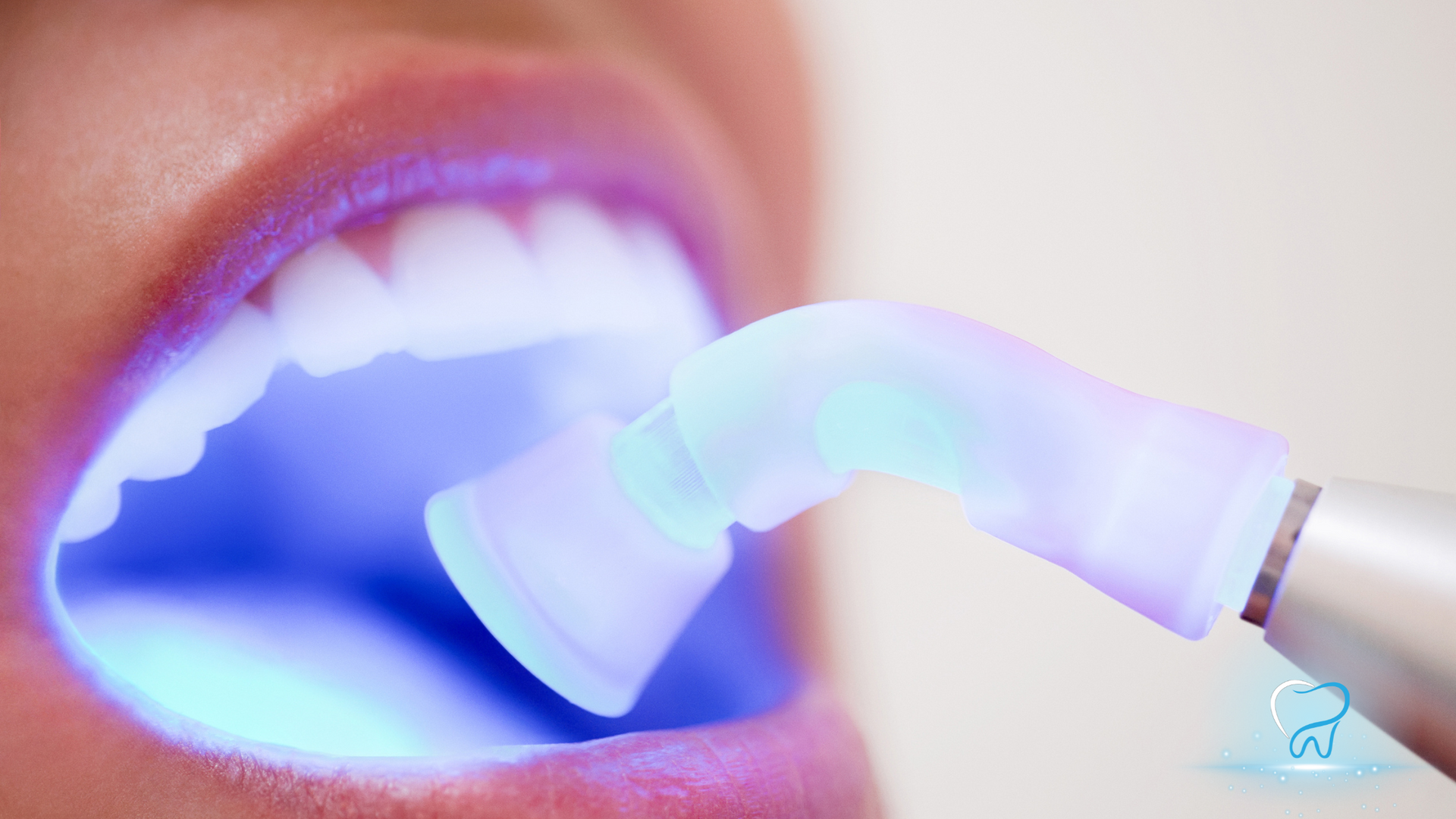 Dental tool curing a bright blue light inside an open mouth during a tooth treatment