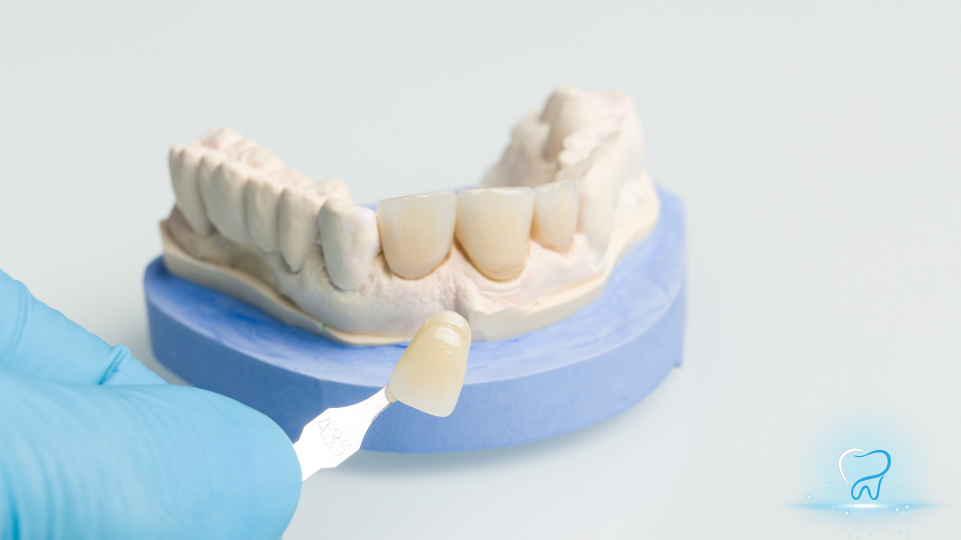 Gloved hand applying material to a dental model of teeth with a blue base