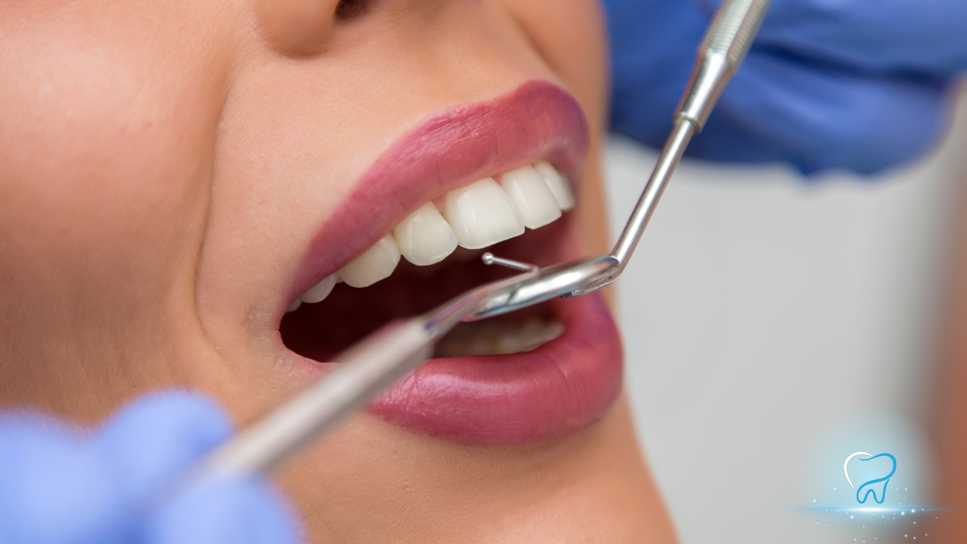 Dentist examining a patient’s open mouth with dental tools and gloved hands