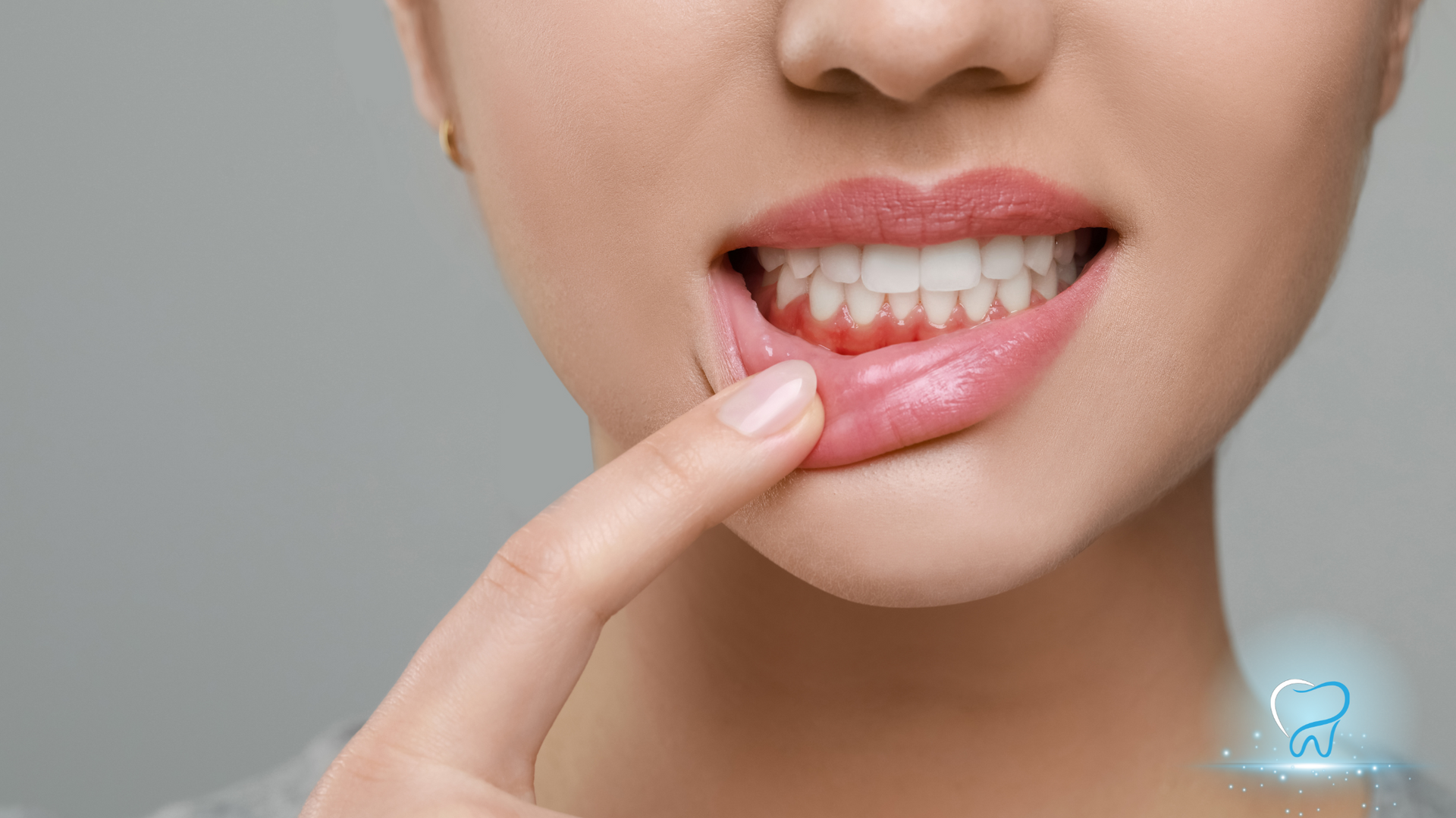 Close-up of lips and teeth as a finger pulls down the lower lip to show the gums