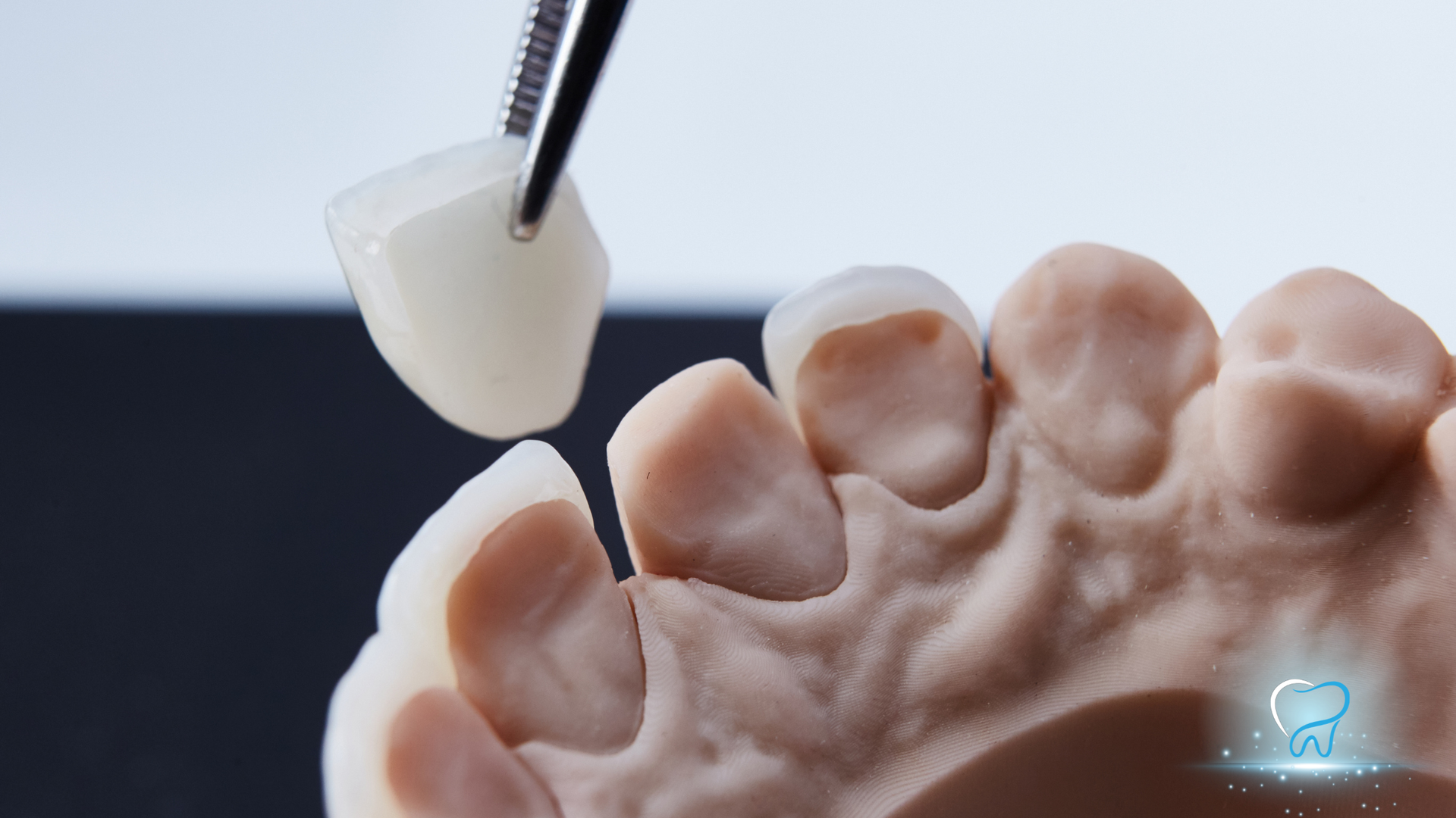 Dental mirror examining a plaster model of teeth against a dark background