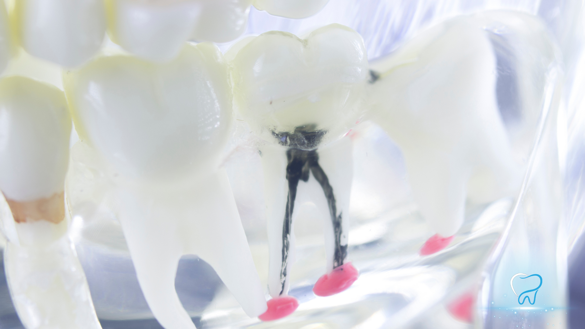 Close-up of white teeth with a black dental floss thread between the front teeth