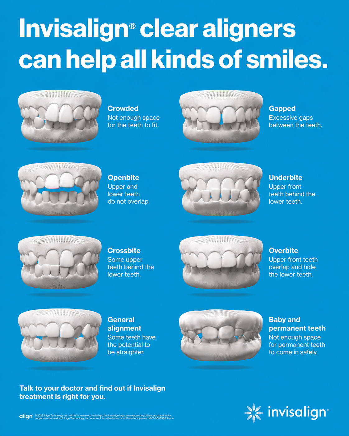 Invisalign ad showing clear aligners treating various teeth alignment cases.
