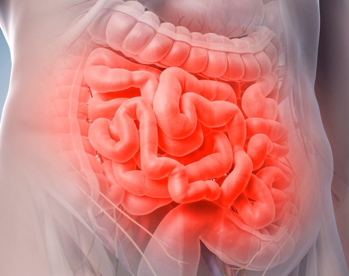 Gastroenterologista em Goiânia para Supercrescimento Metanogênico Intestinal Gastroenterologista em Goiânia para Supercrescimento Metanogênico Intestinal