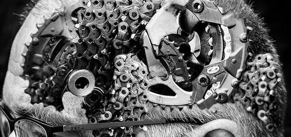 Artistic interpretation of metal cogs in the brain