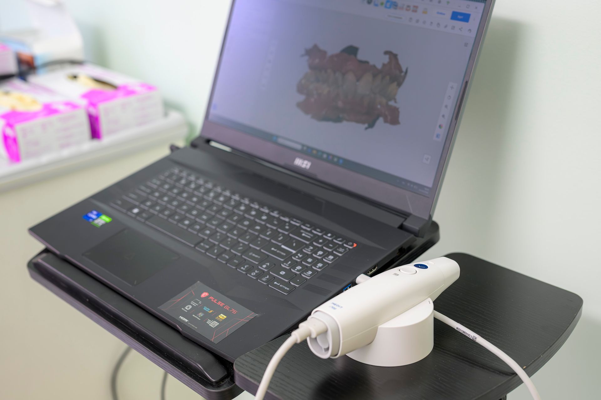 Scansione digitale ai denti ravenna