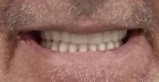 Close-up of a smiling mouth with visible white teeth and light facial stubble
