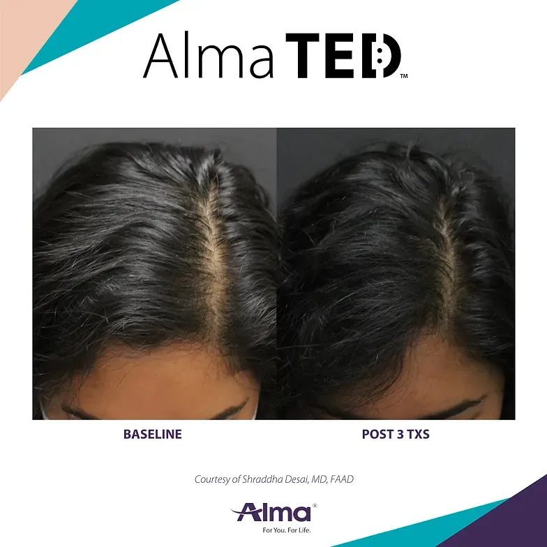 A before and after picture of a woman 's hair