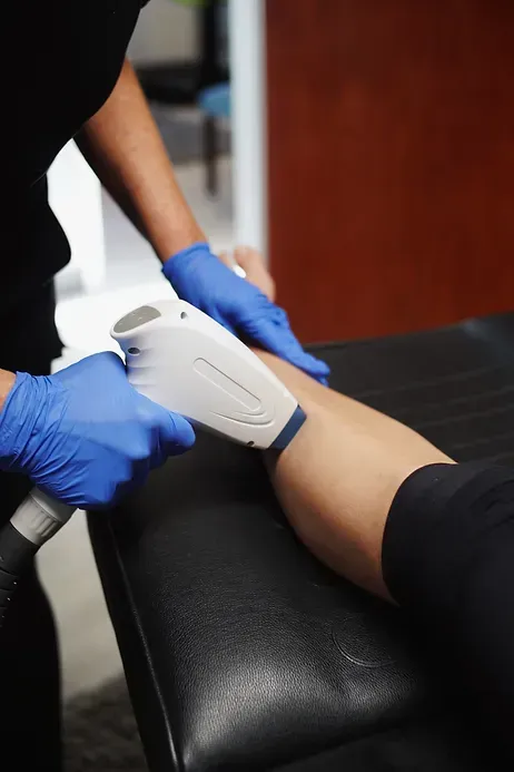 A person is getting a hair removal treatment on their arm.
