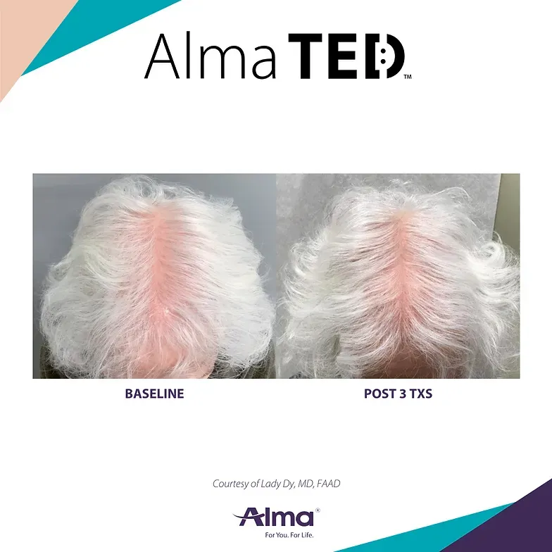 A before and after picture of a woman 's hair