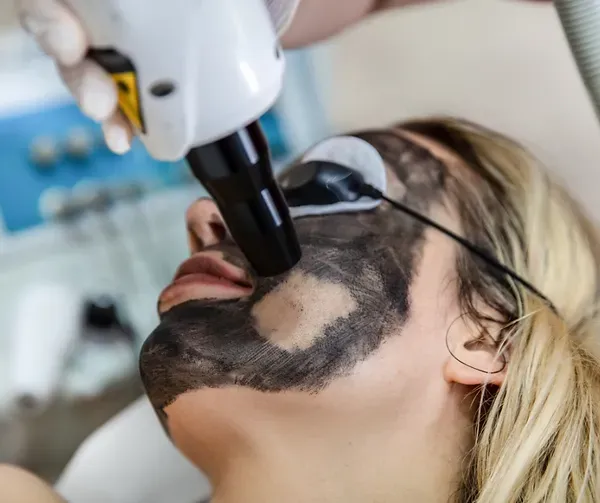 A woman is getting a charcoal mask on her face.