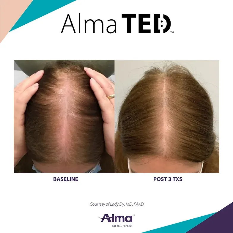 A before and after picture of a woman 's hair