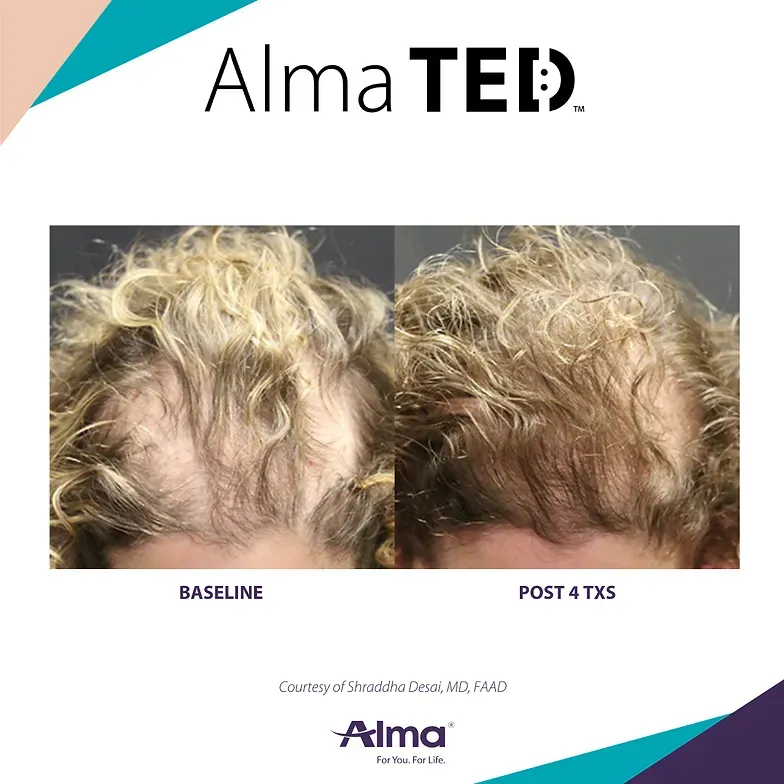 A before and after photo of a man 's hair