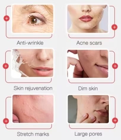 A woman 's face is shown with different types of skin problems.