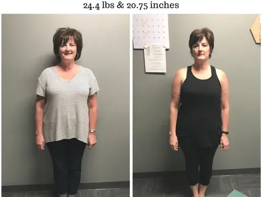A before and after photo of a woman 's weight loss
