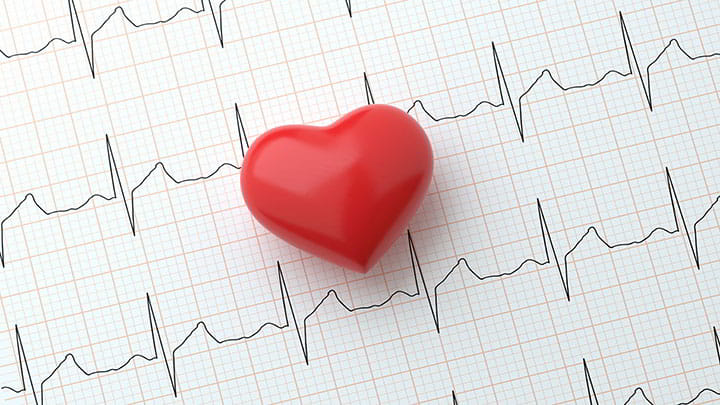 Arritmias cardiacas