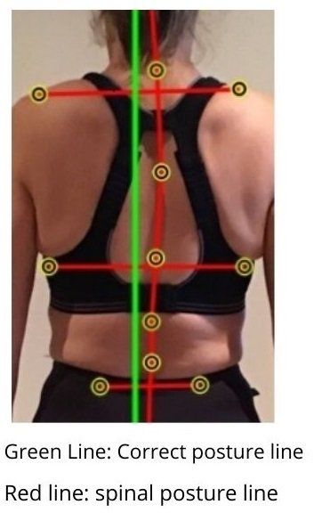 Posture Correction