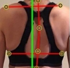 Posture analysis