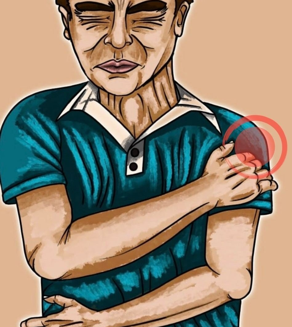 Man with Biceps Tendinitis
