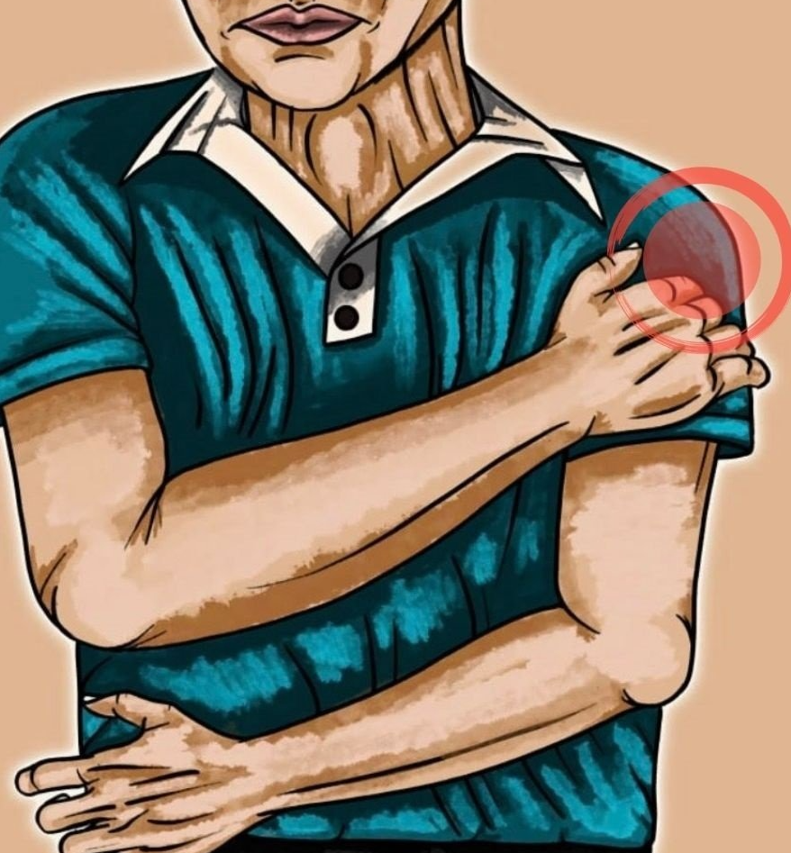 man with anterior shoulder pain
