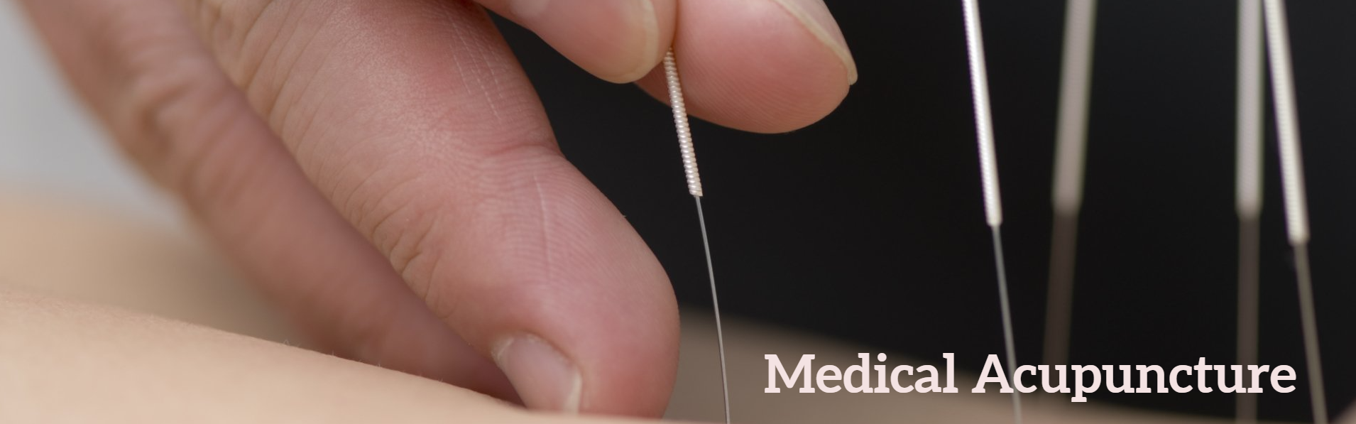 Medical Acupuncture