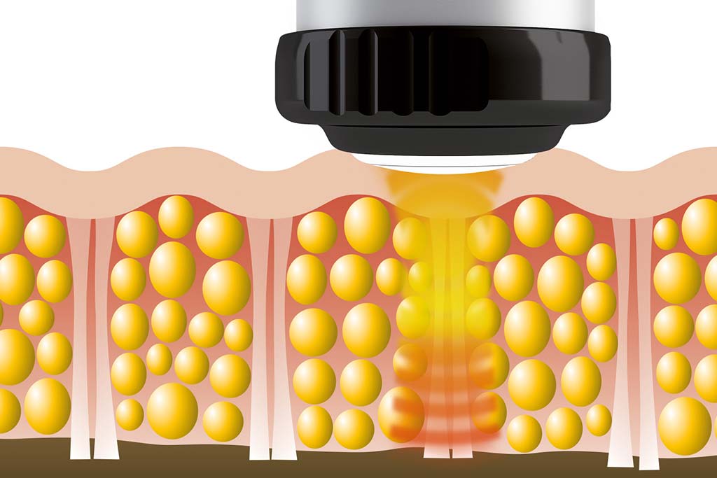 riabilitazione fisioterapica