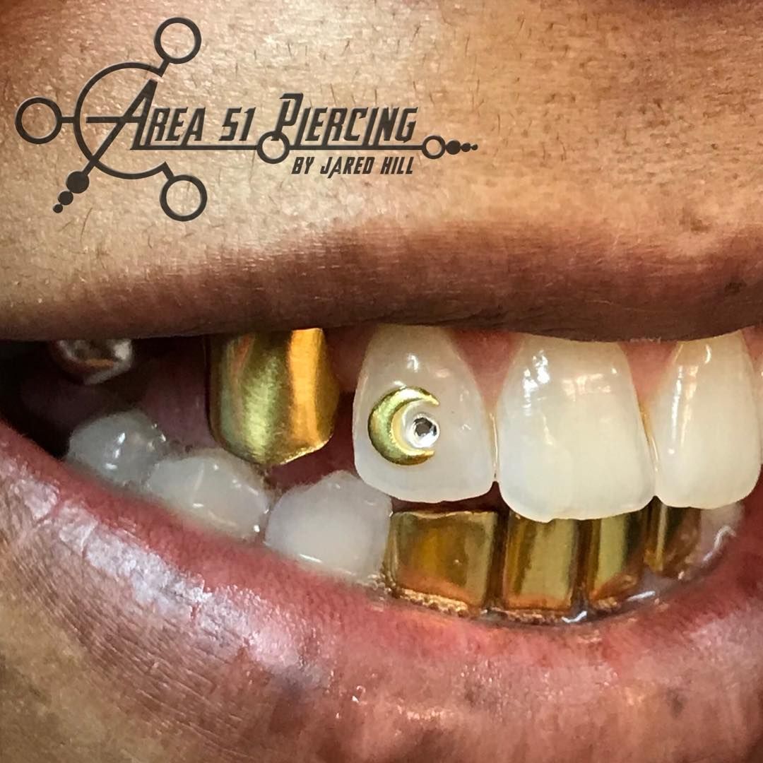 Tooth gem near me