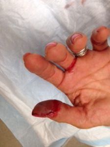 A Hand With Blood — Portsmouth, NH — Lager Susan R A Hand With Blood — Portsmouth, NH — Lager Susan R