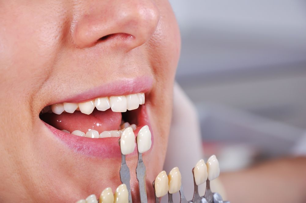 Cosmetic Dental