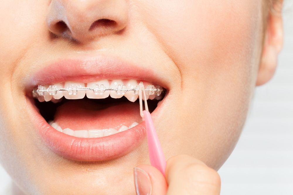 A Woman With Braces Is Flossing Her Teeth With A Pink Toothbrush — Aspire Dental in Townsville, QLD
