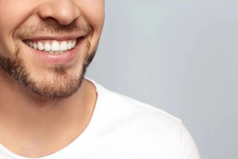 Man After Cosmetic Dental in Townsville