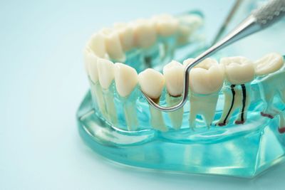 Modello dentale con base verde acqua e uno strumento odontoiatrico in metallo che esamina i denti