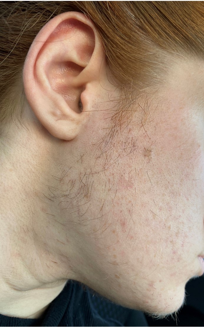 Electrolysis Franklin, TN Electrolysis & Skin Care By Marina