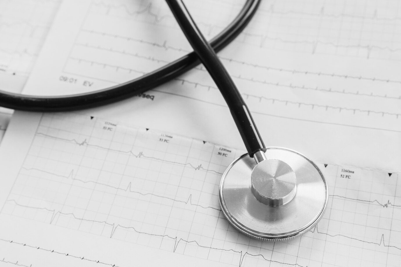 Un estetoscopio está situado encima de un gráfico de latidos del corazón.