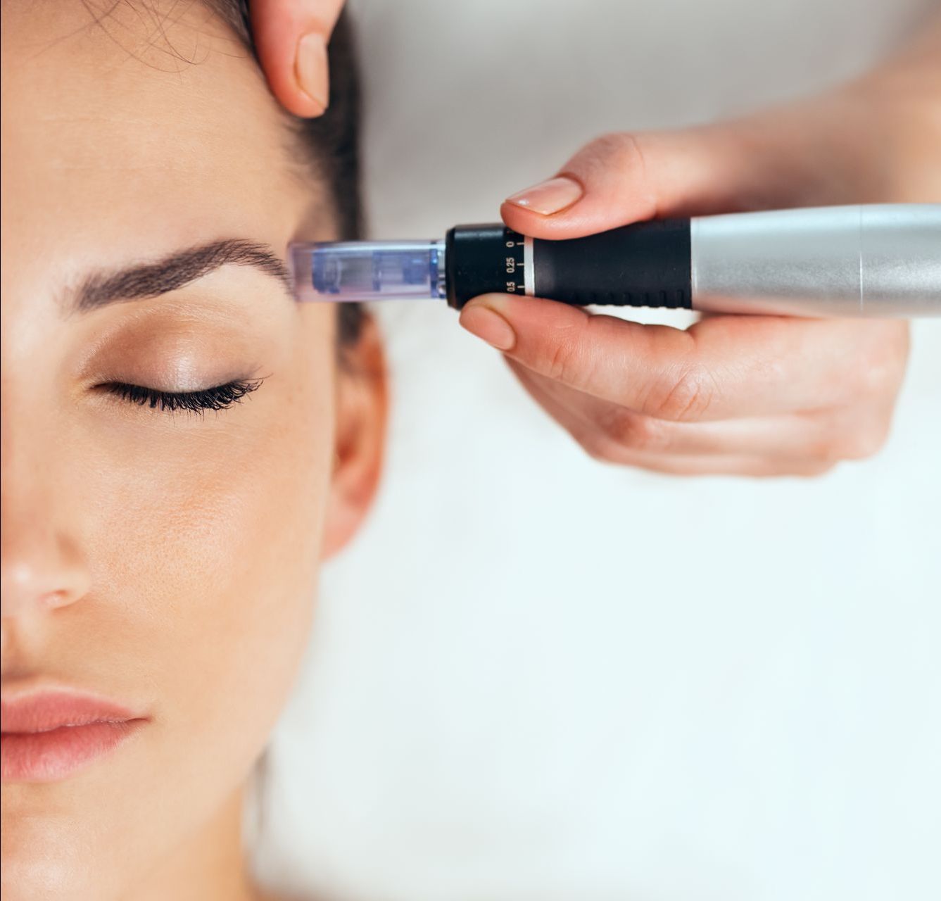 A woman is getting a microneedle treatment on her forehead.