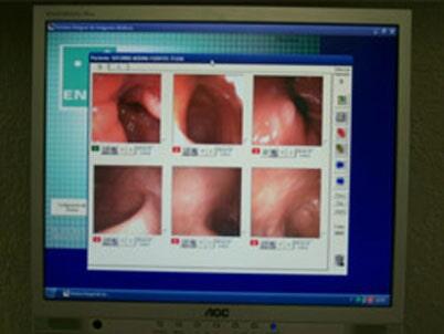 DR JOSE MIGUEL VALDEZ LOPEZ - Tomografía helicoidal