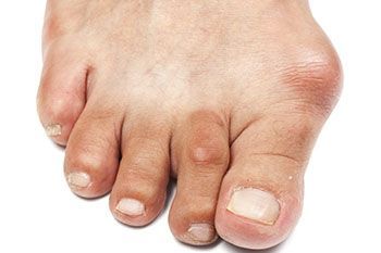 Foot next to a black shoe, a finger pointing at the side of the foot on a wooden floor.