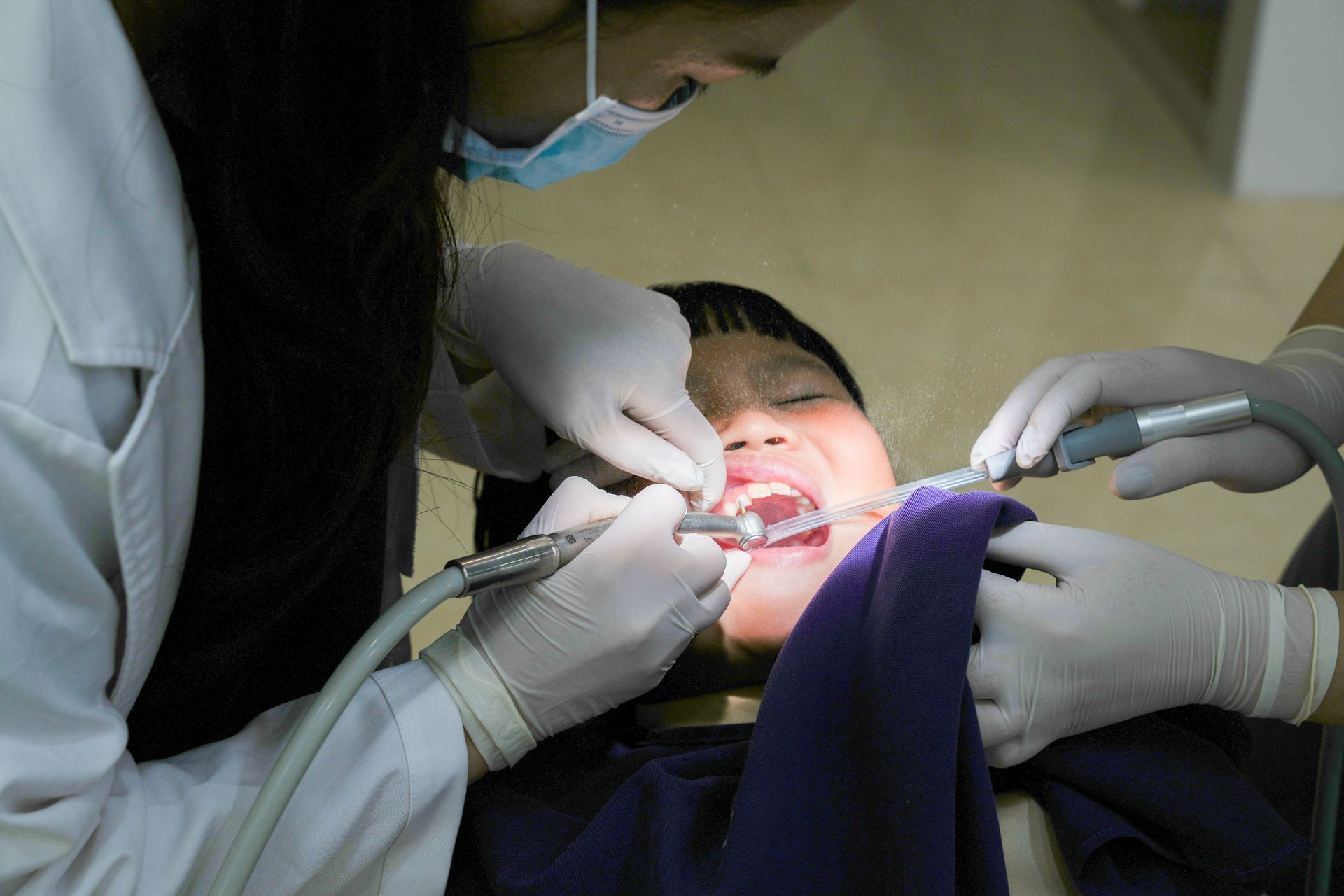 Dentist performing a lip tie procedure at Robert A. Lantzy DMD, Lip Tie treatment in Newtown, PA