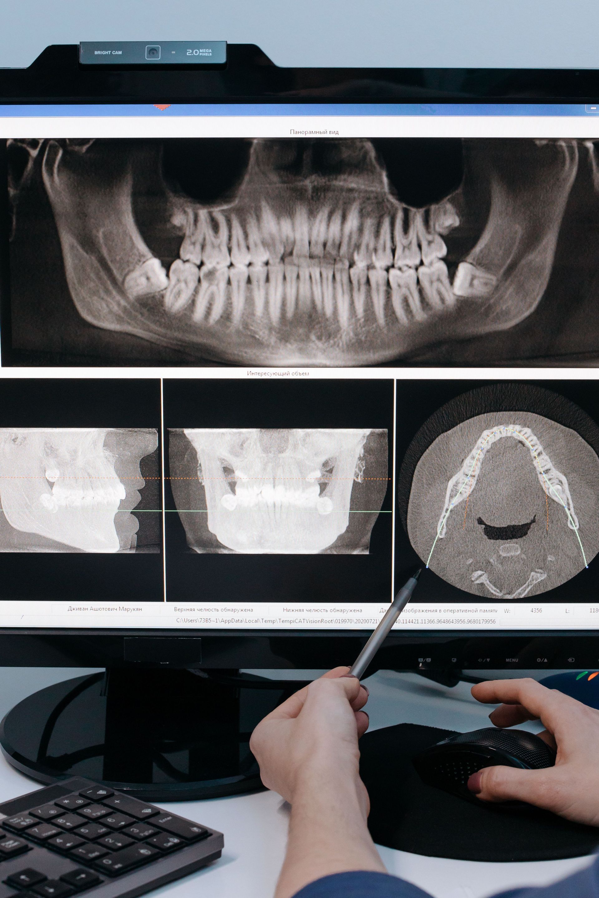 Emergency dental X-ray review at Robert A. Lantzy DMD, Same-Day Emergency Care in Newtown, PA